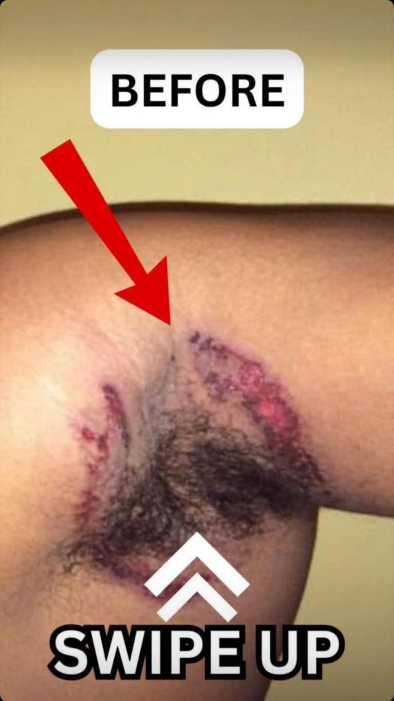 What Causes this.