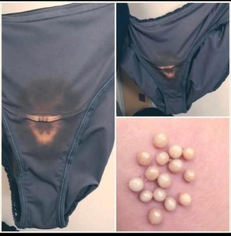 BE CAREFUL, if you notice this in your u