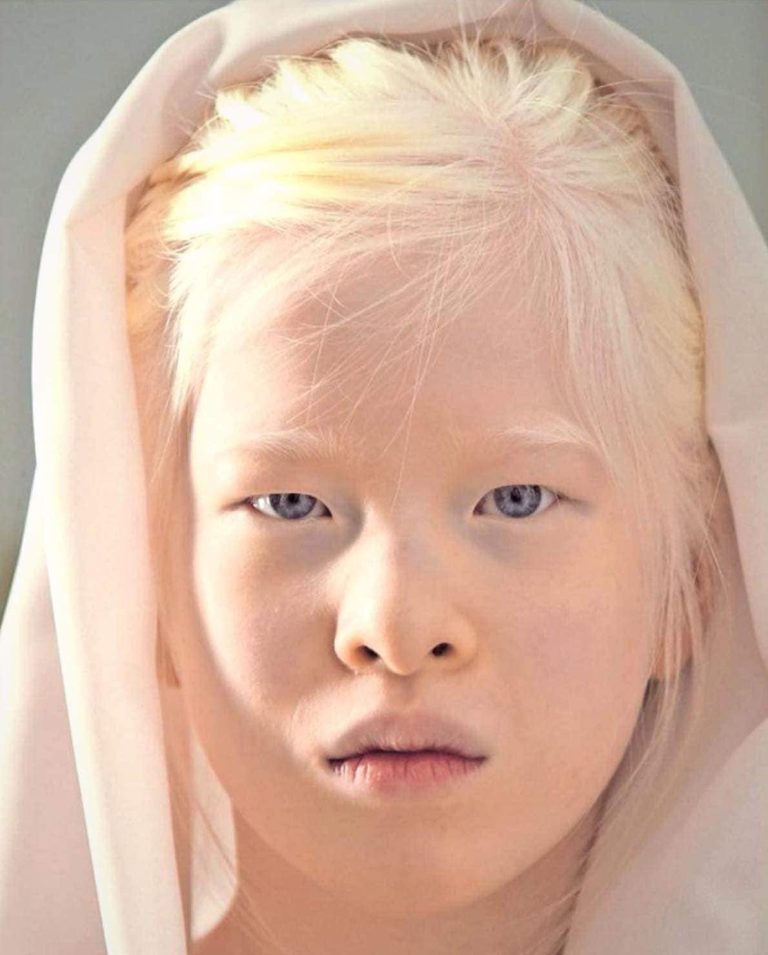 Abandoned as a baby due to her looks, she’s determi