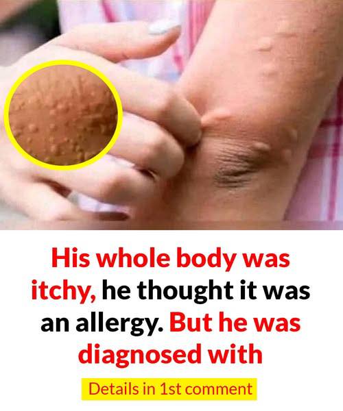 When an Itch Isn’t Just an Itch: