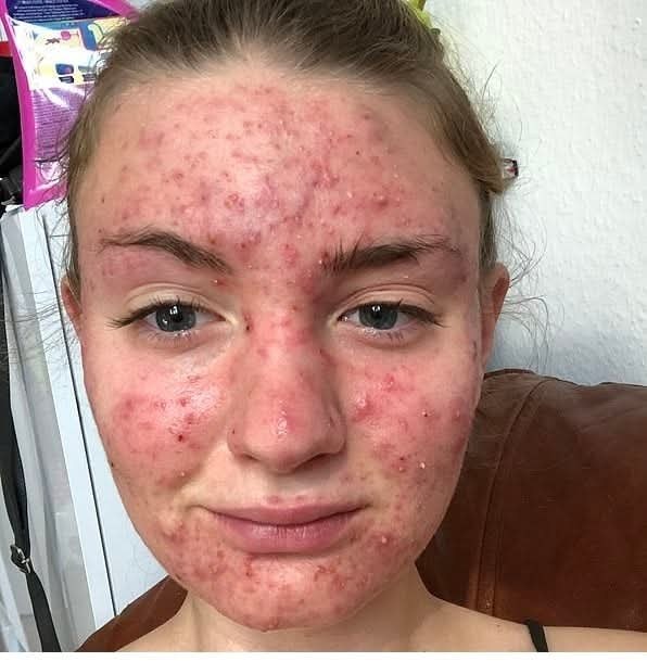 Her body was itching, I thought it was an allergy,
