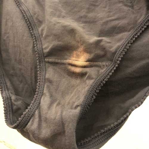 If You Find A “Bleach” Patch On Your Underwear