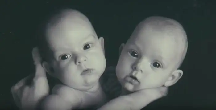 Conjoined Twins Bella And Abby Were Genuinely