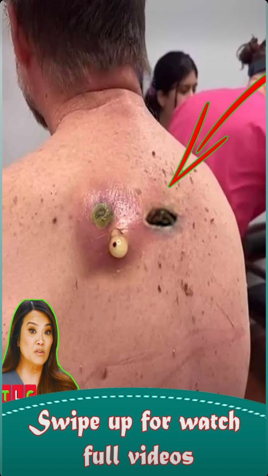 How Skin Texture Changes Reveal H - HORIZON VIBE