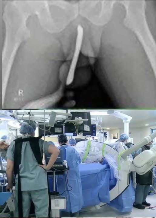 Girl had to be hospitalized for wanting to use a pe..