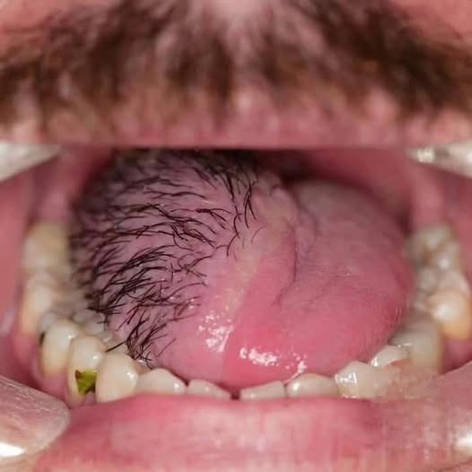 These are the consequences of eating …See more