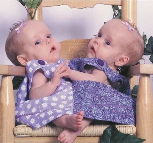 The twins Kendra and Maliyah Herrin arrived