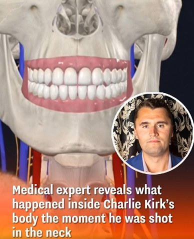Medical Expert Explains What Happened in Charlie Kirk’s