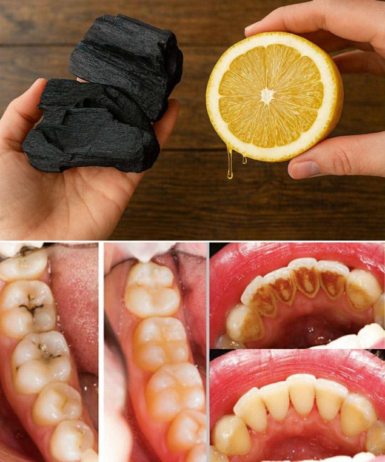 The magic of lemon juice and activated