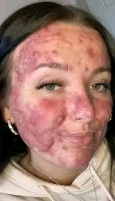 Her body was itchy, he thought it was