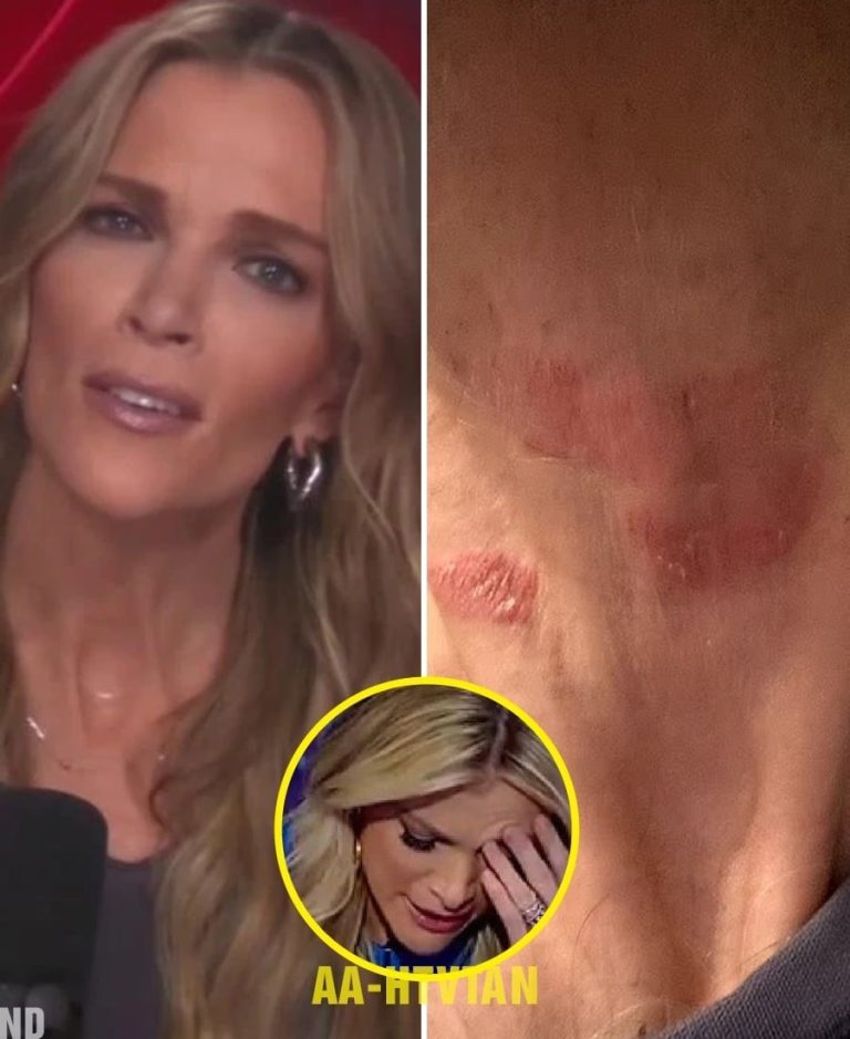 Megyn Kelly Hospitalized in Critical Condit