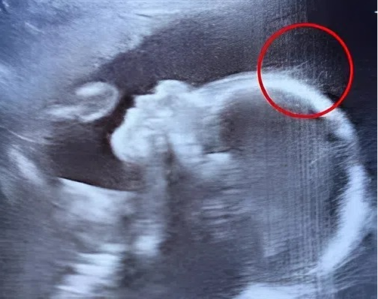 The Tiny Titan of Hair: A Baby’s