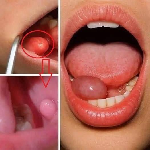 These are the first symptoms o