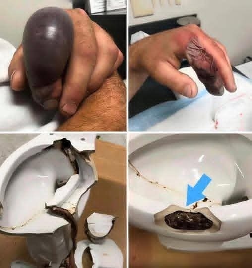 In several regions, while using their toilet