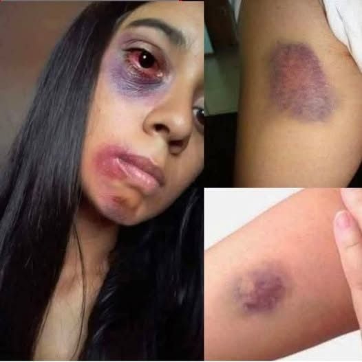 Young woman dies at the hands of her