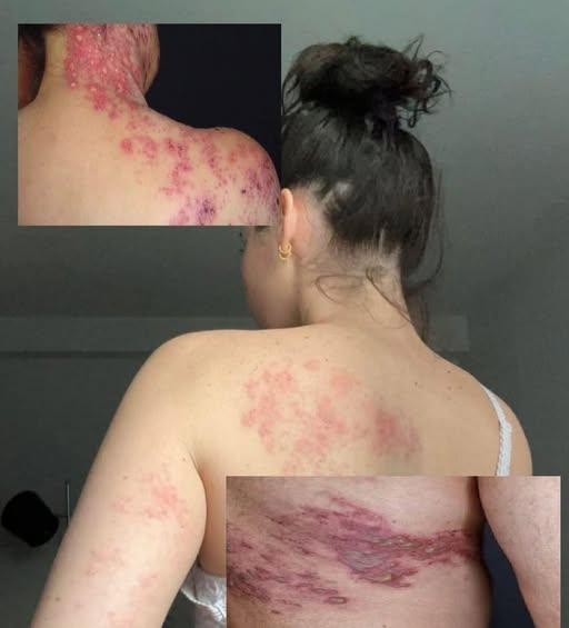 These are the consequences of sleeping with your