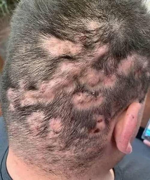 Early warning signs: signs that y