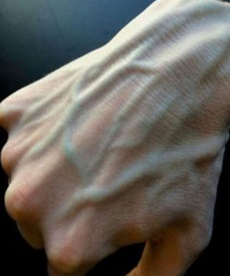 Visible Veins Explained! Normal Causes