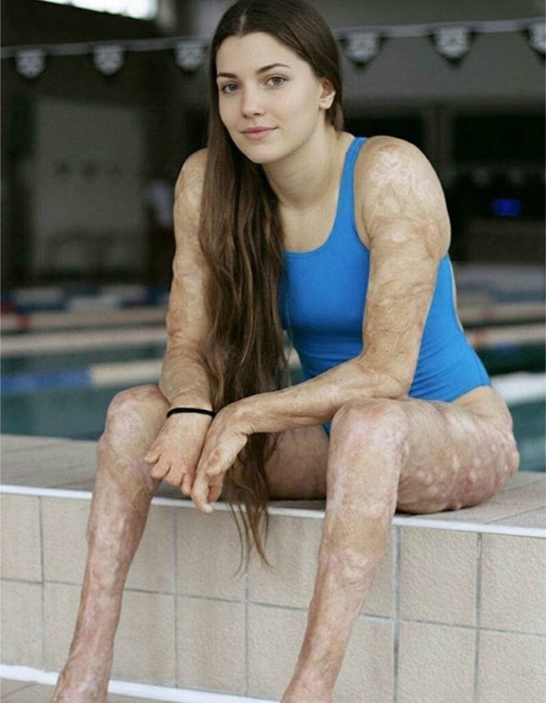 These are the consequences