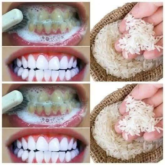 Teeth Whitening Trick with Rice