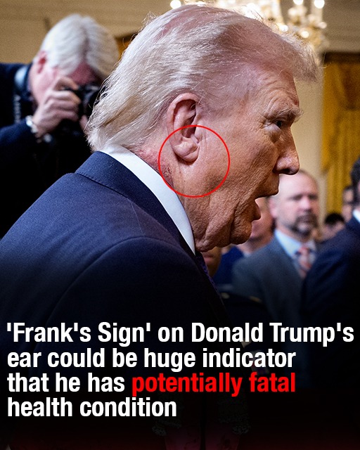 ‘Frank’s Sign’ on Trump’s ea