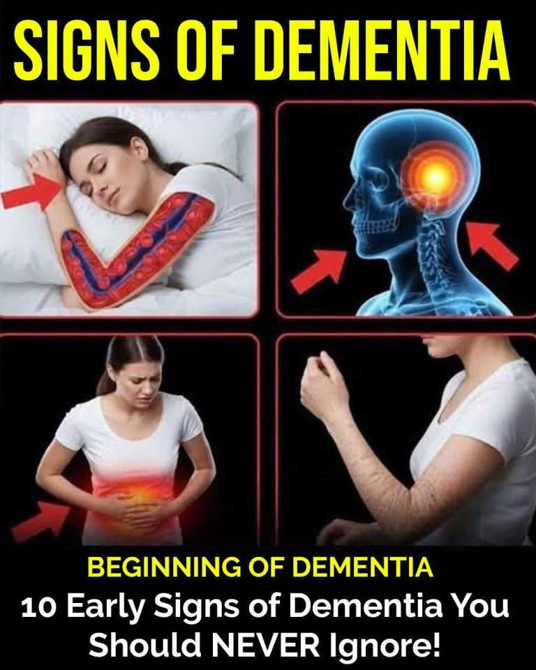 10 signs of dementia you shou