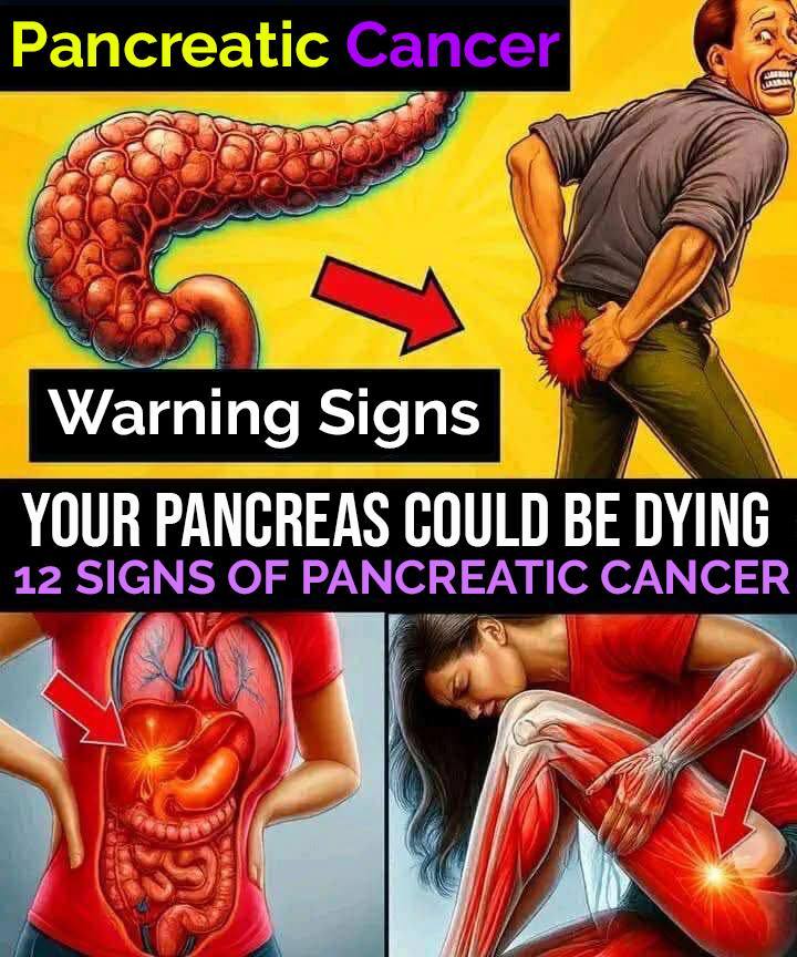 Signs of pancreatic cancer you shou