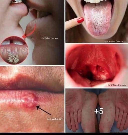 These are the signs that 3