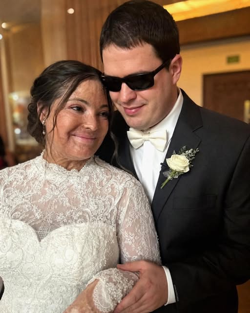 I Married a Blind Man So He’d Never Se