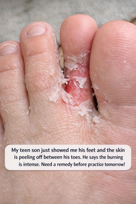 My teen son just showed me his feet a