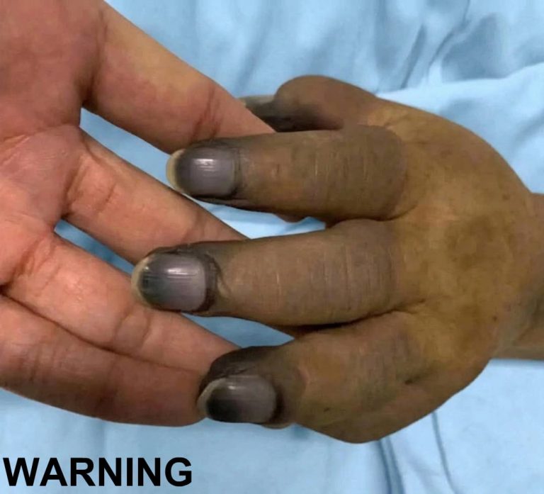These are the consequences of painting your nails 