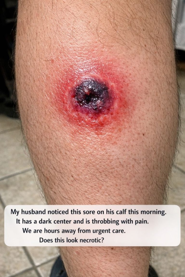 My husband noticed this sore on his calf this m