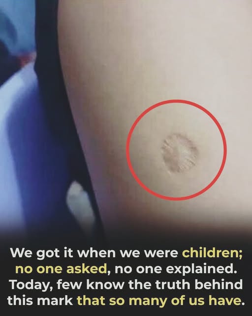 What the small round scar on your arm 