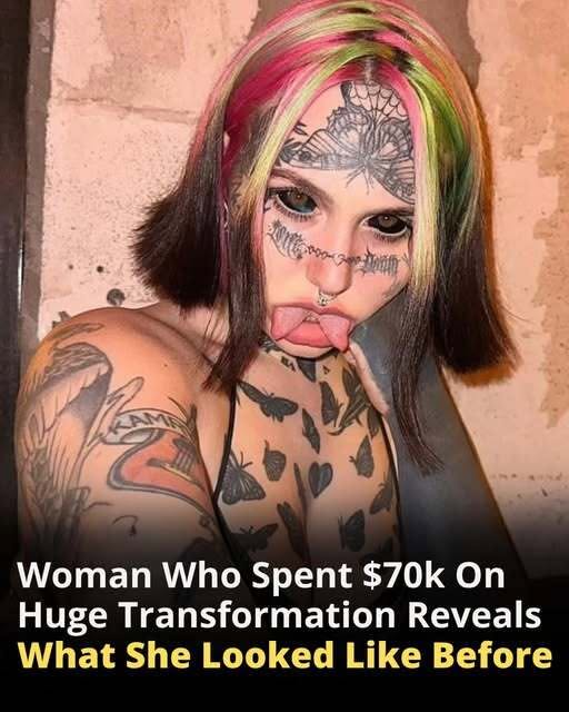 She Spent $70,000 on Cosmetic Procedures