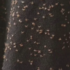 These Tiny Things Covered My Pant Leg After a W