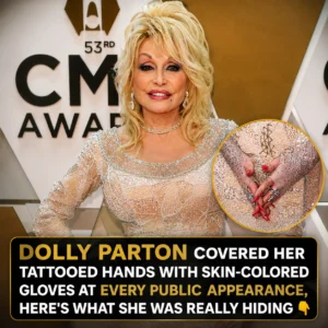 Dolly Parton Covered Her Tattooed Hands With Skin-Colore