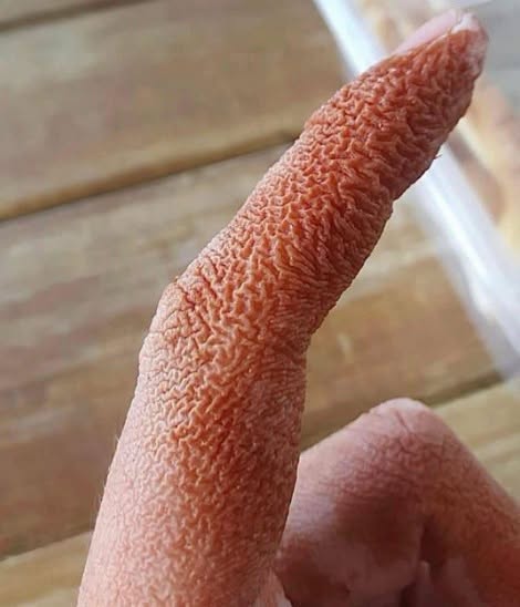 How an Unusual Rash Can Lead