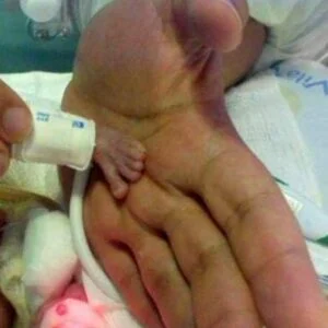 One of the smallest babies