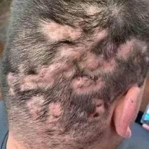 Man hospitalized after allowing hims