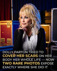 Dolly Parton Rarely Showed Her Tattoos