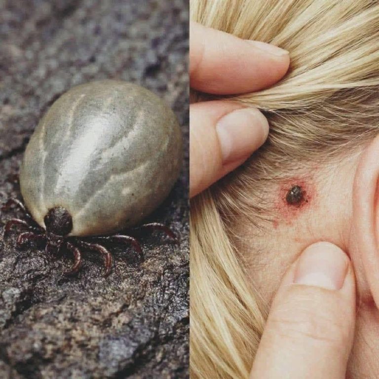 Found a Weird Bug in Your Child’s Hair? What Parents 