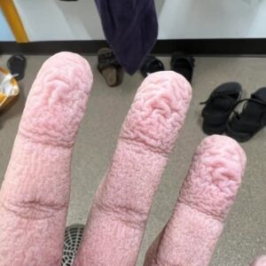 Wrinkled Fingers After Water Exposure: What Your Ski