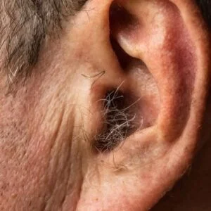 Did You Know That If Hair Grows On Your Ears It Is Not A Sign Of Illnes
