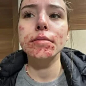 She Woke Up With These Unexpected Skin Chan