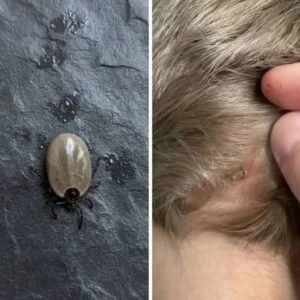 Does Anyone Know What Kind of Bug This Could Be? A P