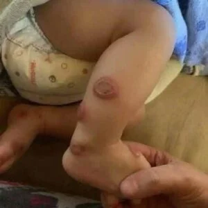 ALERT: These are the signs that it