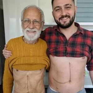 Son who donated part of his liver to his